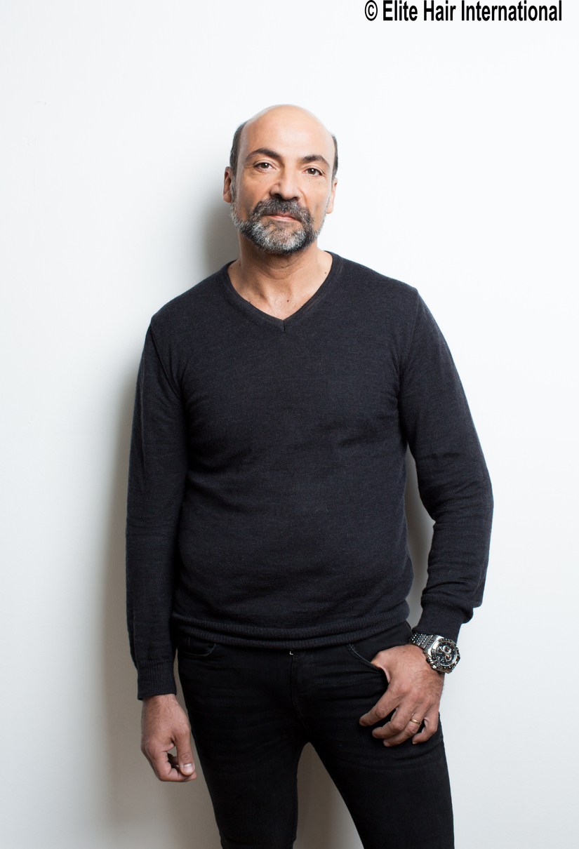 Avant/après Dermofusion 4 Nathalie Antoun